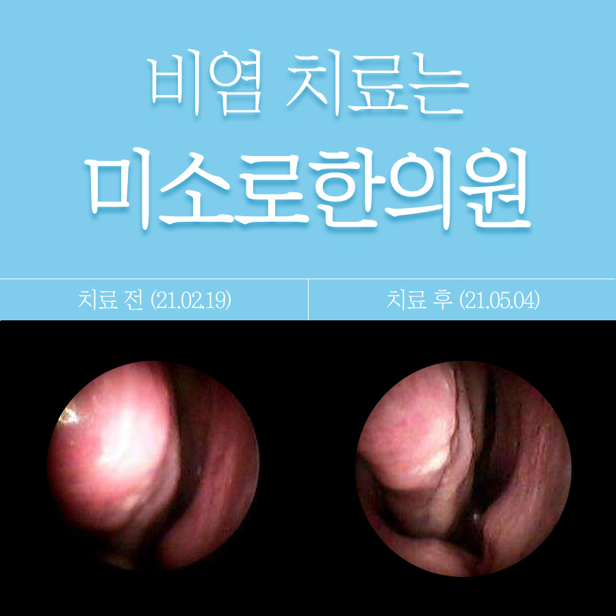 성남 고양이 알러지 비염 약 관련 이미지