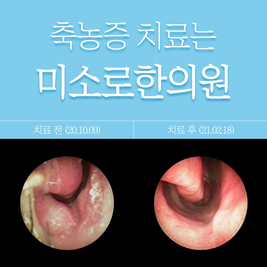 분당 축농증 수술 후기 통증 관련 이미지