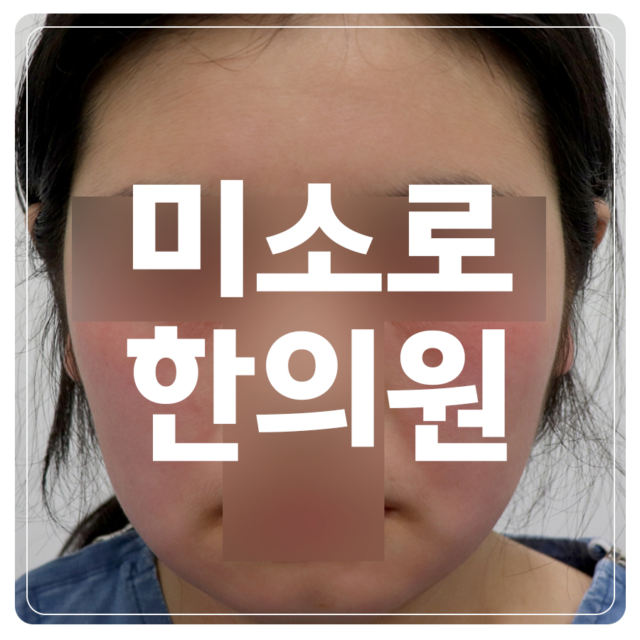 송천동 허벅지 습진 이유 관련 이미지