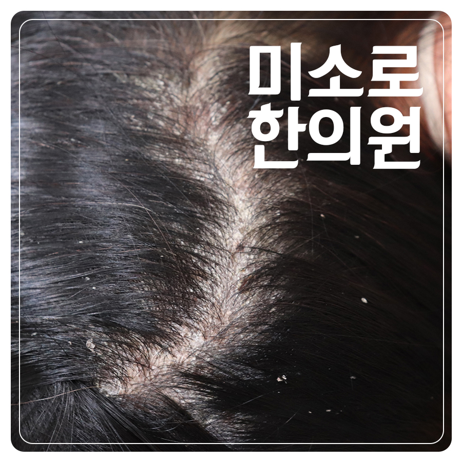 여주 피부 건선 병원 추천 관련 이미지