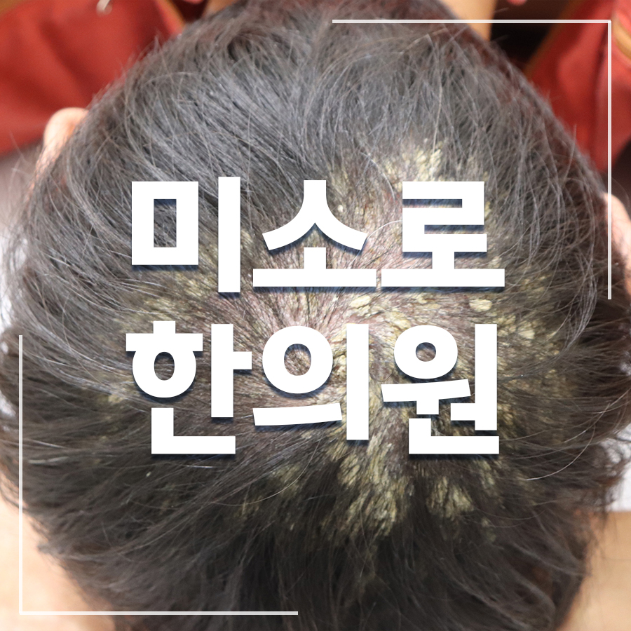 판교 건선한의원비용 관련 이미지