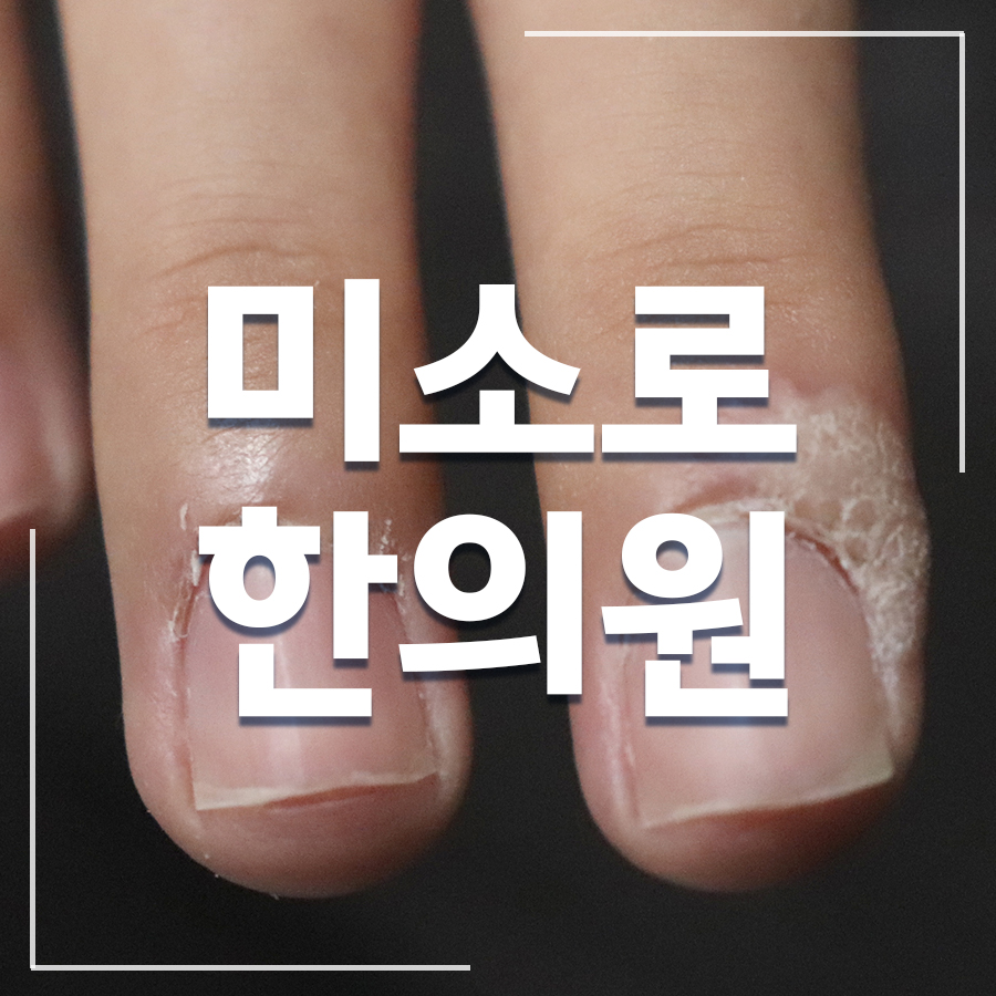 성남 편평사마귀면역치료 병원 관련 이미지