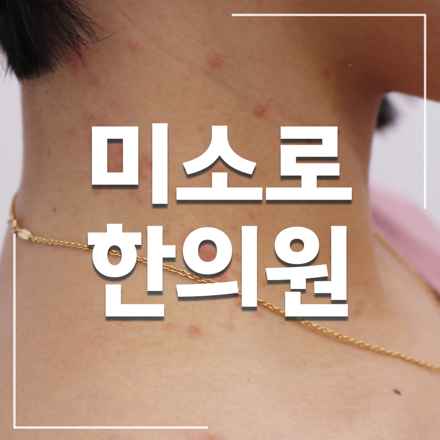 시흥 습진 가려움 완화 관련 이미지