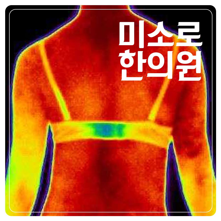 분당 얼굴 다한증 치료 관련 이미지