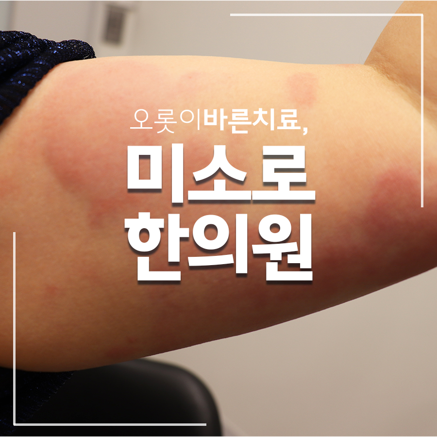 성남 근처 묘기증 한의원 관련 이미지