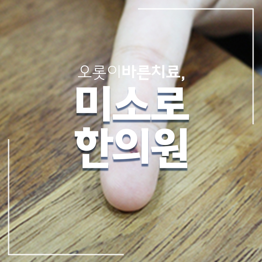 위례 편평사마귀 비용 저렴 관련 이미지
