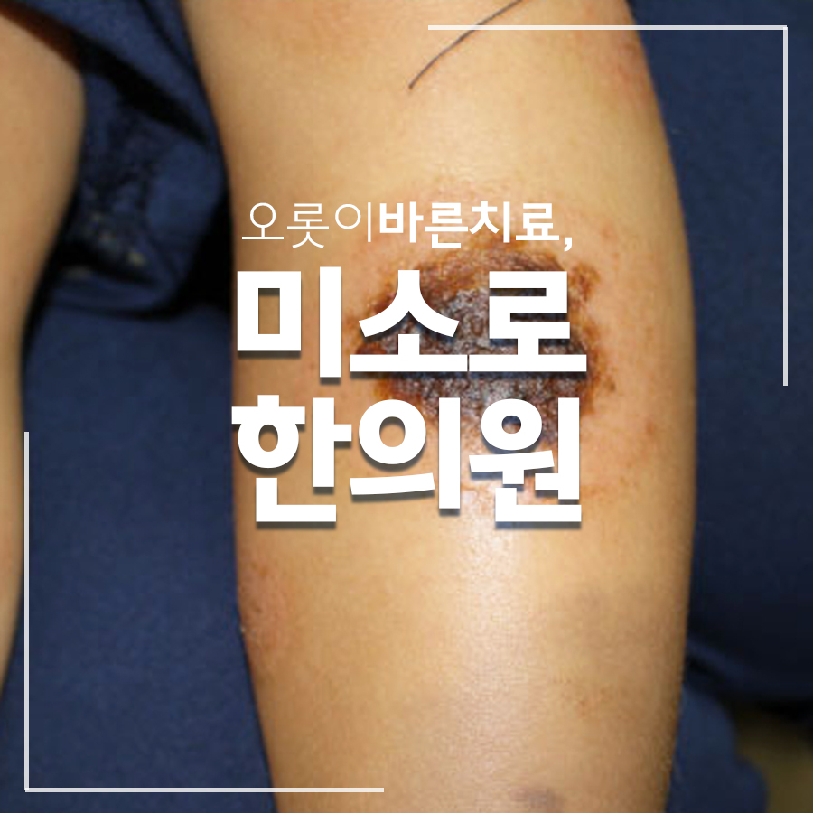 여주 고환 습진 병원 관련 이미지