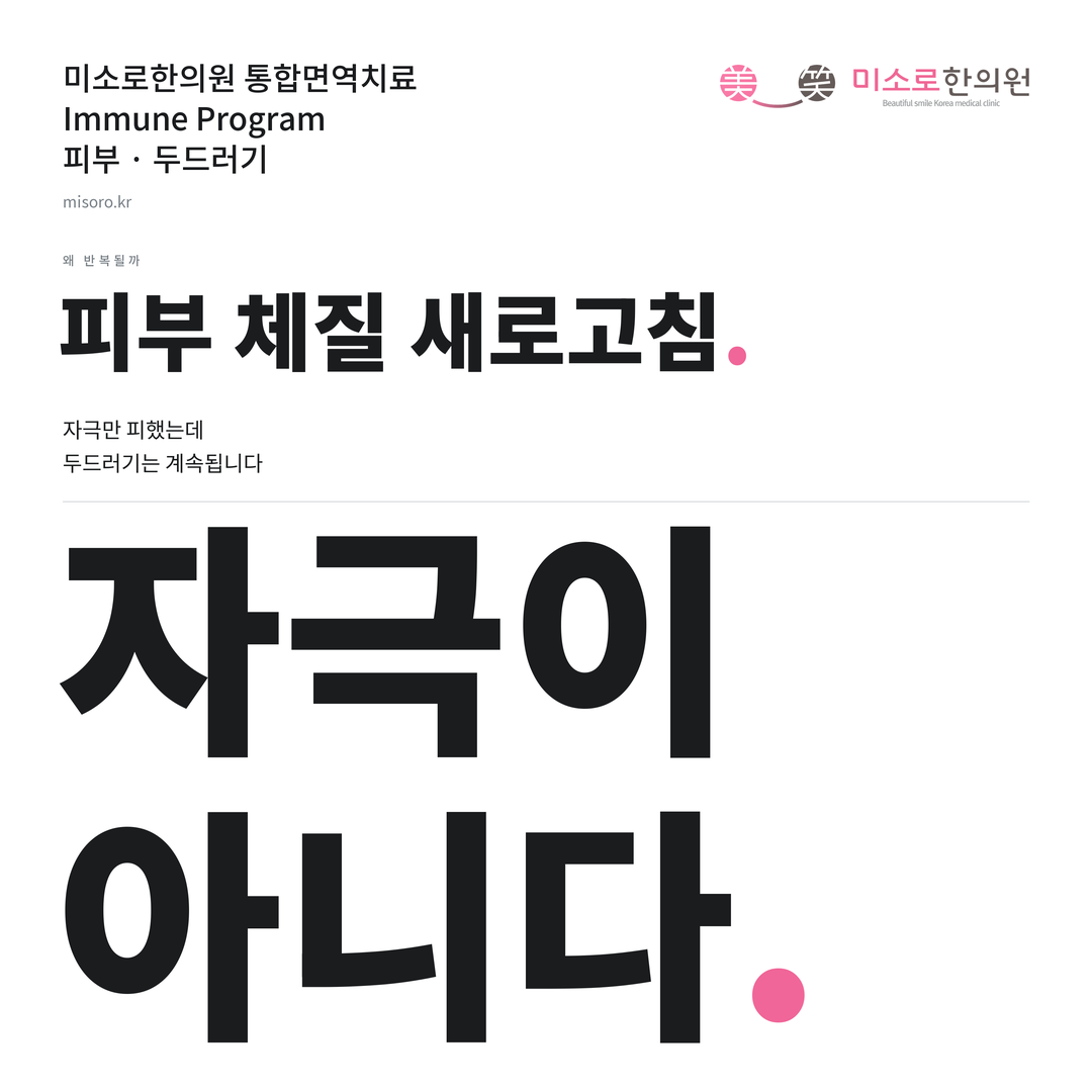 두드러기 카드뉴스 표지 - 자극이 아니다