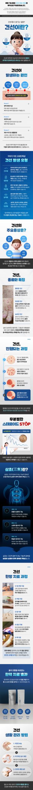 분당 손가락 건선 증상 관련 이미지