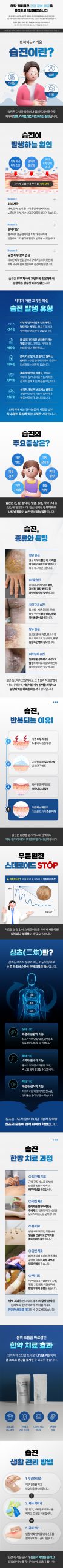 분당 습진 치료 병원 관련 이미지